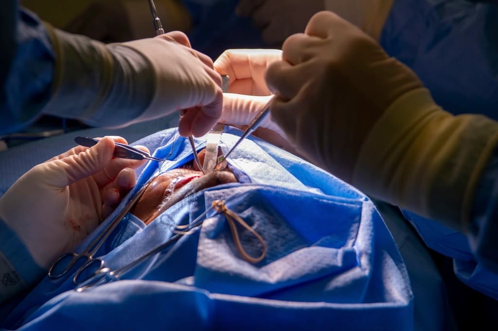 Scleral Buckle Surgery
